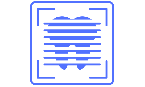 ESCANEAMENTO INTRAORAL